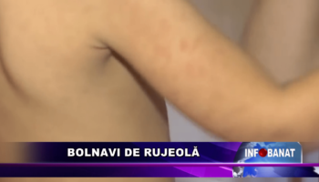 Bolnavi de rujeolă